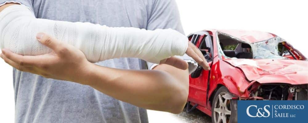 man in arm cast after car accident