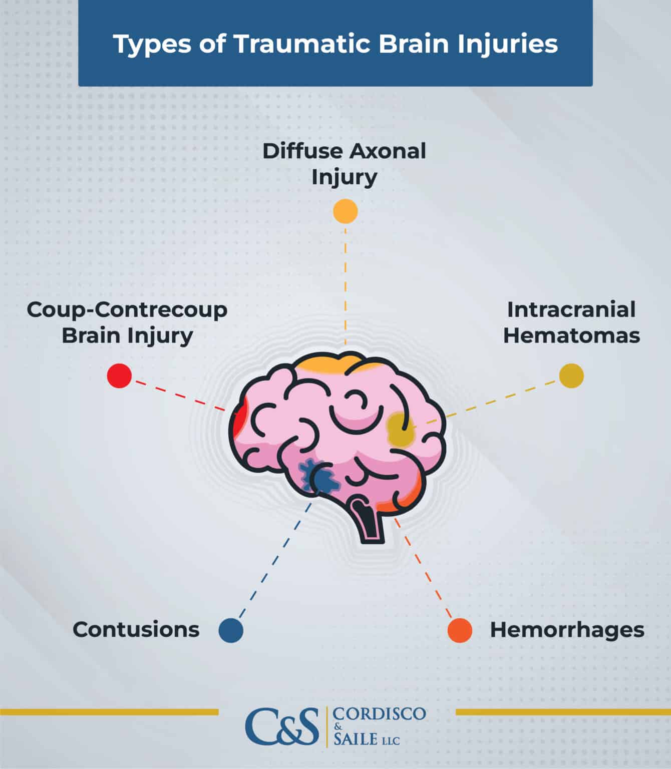 Pennsylvania Traumatic Brain Injury Lawyer | Cordisco & Saile LLC