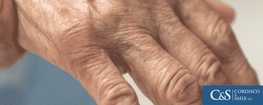 And aged man's hand